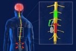 Микрочип вылечит хроническую боль