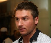 Сергей Лазарев получил ожог головы