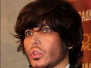 Сергея Зверева избили