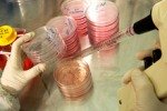 Ученые придумали, как можно быстро выращивать стволовые клетки