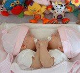 В США разделили сиамских близнецов