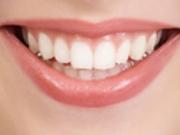 Лучшие способы отбеливания зубов