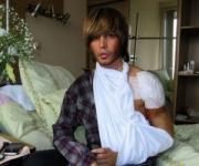 Зверев решил продать свой гипс