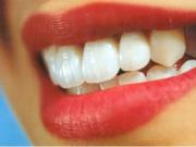 Башкирские многодетные мамы смогут бесплатно протезировать зубы