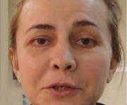 Ирина Агибалова изуродовала лицо