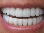 К чему могут привести заболевания зубов