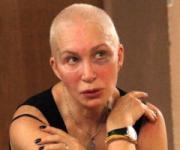 Татьяна Васильева рассказала о синяке под глазом