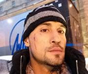 Дима Билан пострадал на концерте