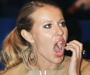 Собчак сделала пластическую операцию