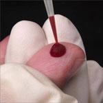 В Ингушетии все желающие пожениться должны сдавать анализы на ВИЧ