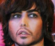 У Сергея Зверева после неудачной пластики перестал закрываться рот