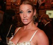 Анастасия Волочкова серьезно пострадала в ДТП