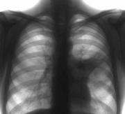 Бесплатную флюорографию призывает пройти горожан администрация Ставрополя