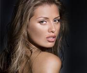 Виктория Боня удивила распухшими губами