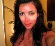 Ким Кардашьян получила сильный ожог