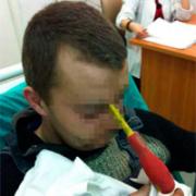 Поляк случайно обнаружил в своём лбу отвёртку