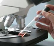 В Пятигорске создан барьер ящуру