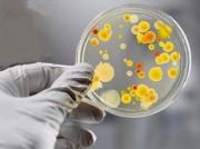 На Ставрополье отмечен рост заболеваемости острыми кишечными инфекциями