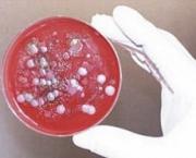 Двое ставропольцев госпитализированы с подозрением на сибирскую язву