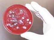 Минздрав: Два случая заболевания сибирской язвой - не повод для паники