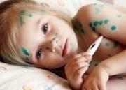 На Ставрополье зафиксирована вспышка кори, заразились более сотни человек