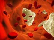 Замминистра здравоохранения СК встретилась с больными гемофилией