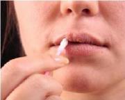 Как лечить герпес?