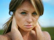 Веснушки - это горе или нет