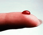 Кровопускание в восточной медицине